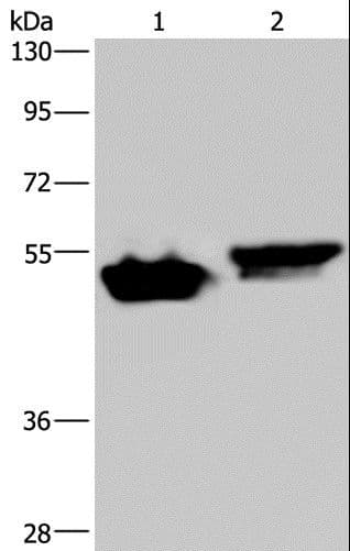 Polyclonal Rabbit anti-Human AVEN / PDCD12 Antibody (IHC, WB)