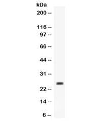 APOA1 / Apolipoprotein A 1 Antibody