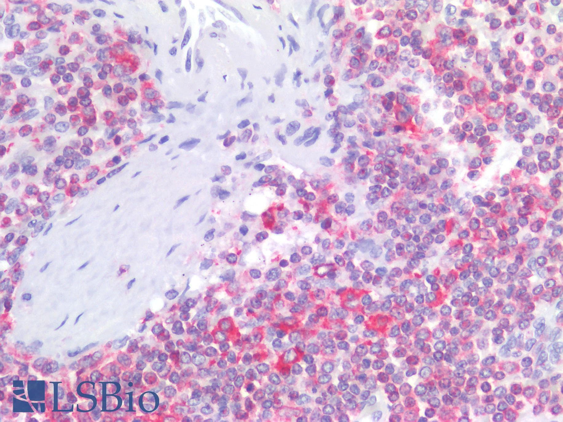 PathPlus™ LSP1 Antibody (aa37-48)