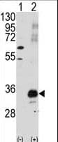 PIM1 / Pim-1 Antibody (aa374-404)