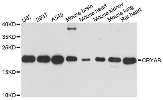 Polyclonal Rabbit anti-Human CRYAB / Alpha B Crystallin Antibody (WB)