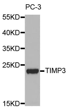 Polyclonal Rabbit anti-Human TIMP3 Antibody (IHC, IF, WB)