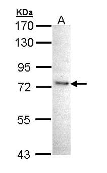 Polyclonal Rabbit anti-Human IKBKE / IKKI / IKKE Antibody (IF, WB)
