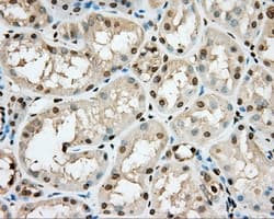 PKG / PRKG1 Antibody (clone OTI9G4)