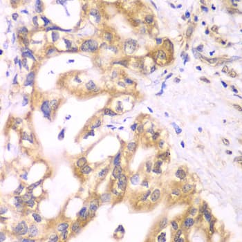 SCAD / ACADS Antibody