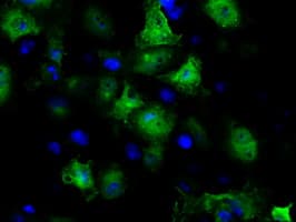 GBE1 Antibody (clone OTI4A1)
