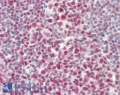 IHC-plus™ STAT1 Antibody (C-Terminus)
