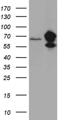 IMP-3 / IGF2BP3 Antibody (clone OTI4H5, Carrier-free)