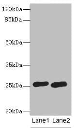 Polyclonal Rabbit anti-Human RAB20 Antibody (IHC, WB)