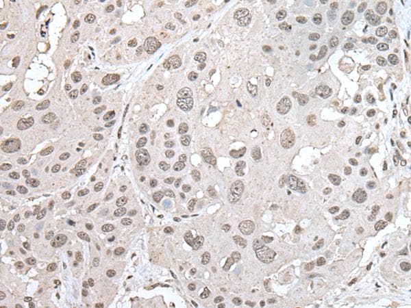 VRK1 Antibody