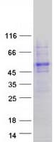 Human UBAP1L Protein (Recombinant Myc-DDK (Flag))