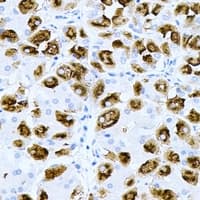 PNMT Antibody
