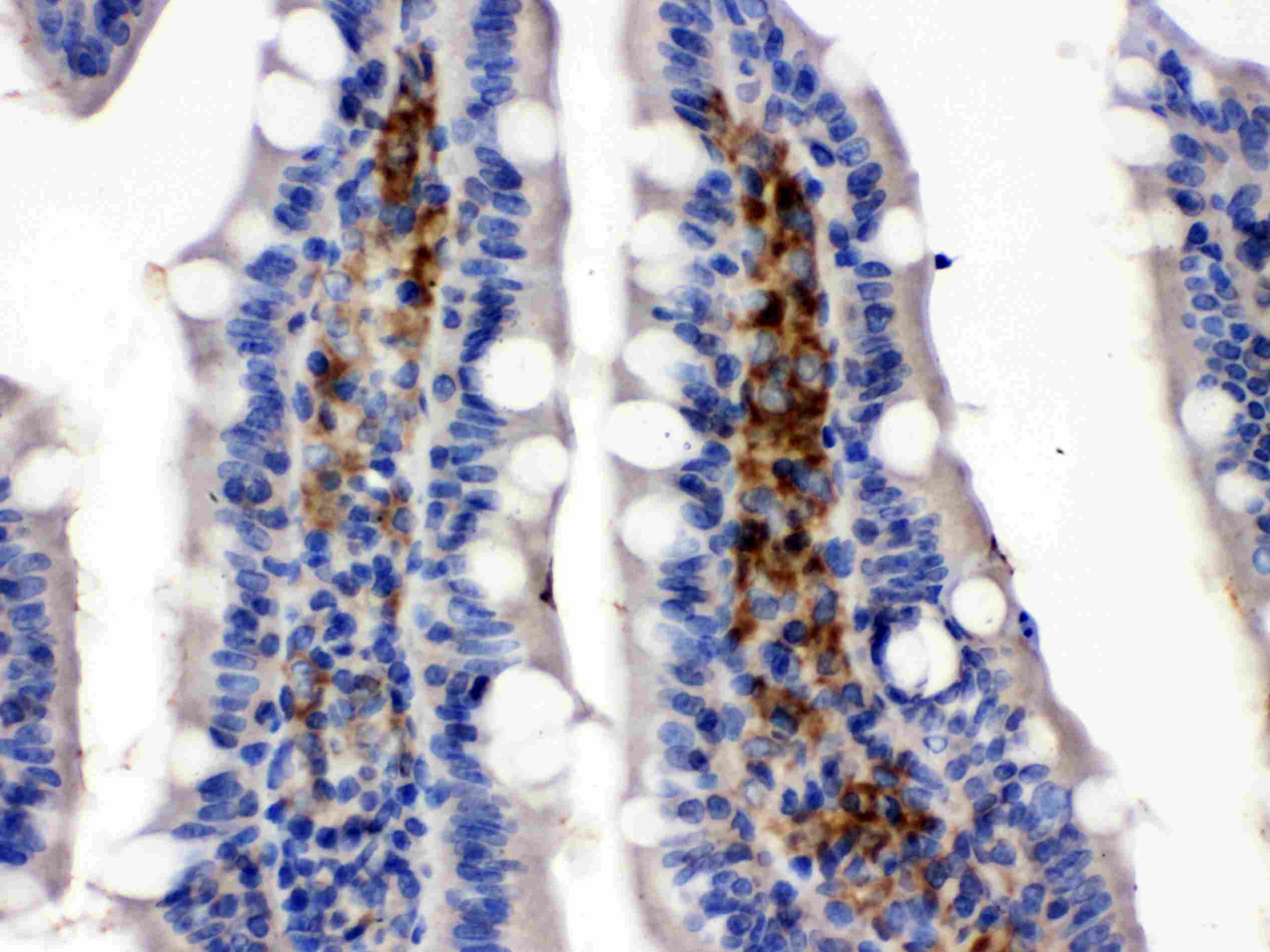 SLC2A5 / GLUT5 Antibody