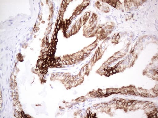 KRT19 / CK19 / Cytokeratin 19 Antibody (aa240-390, clone UMAB187, Carrier-free)