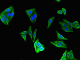 Ceramide Kinase / CERK Antibody