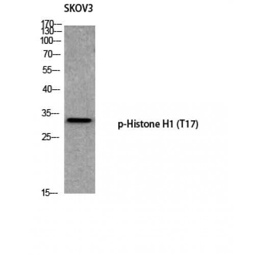 Polyclonal Rabbit anti-Human Histone H1 Antibody (1-80 aa, IHC, IF, WB)