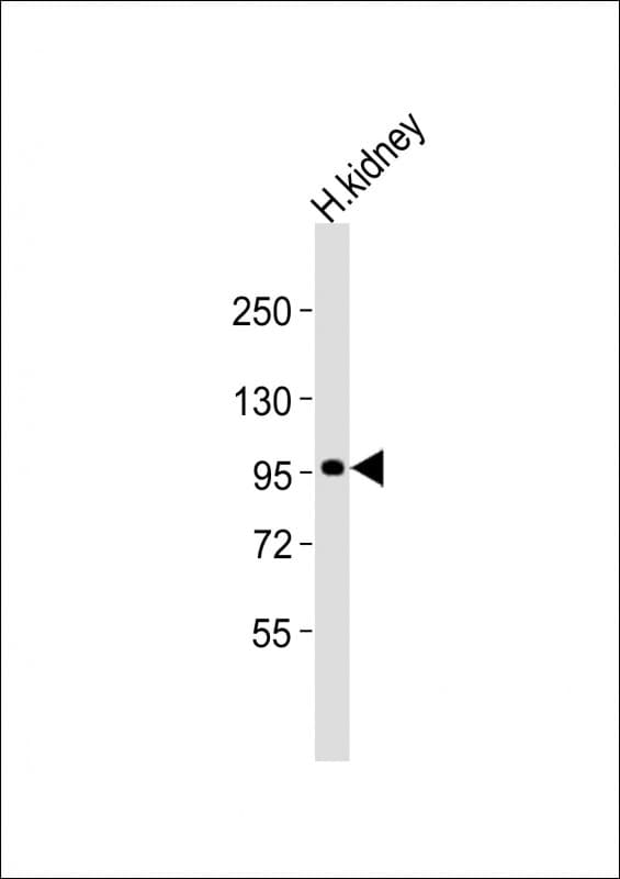 Polyclonal Rabbit anti-Human ADAMTS6 Antibody (aa20-54, WB)
