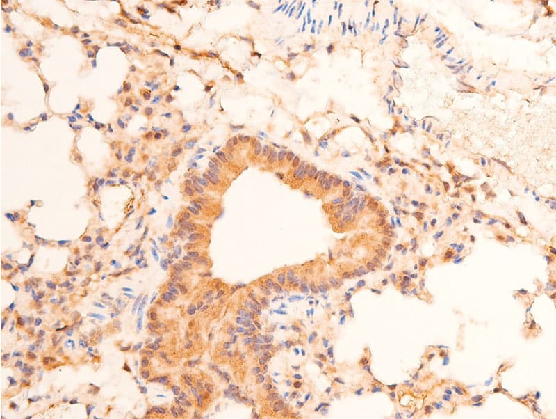 TP53 / p53 Antibody (phospho-Ser15)