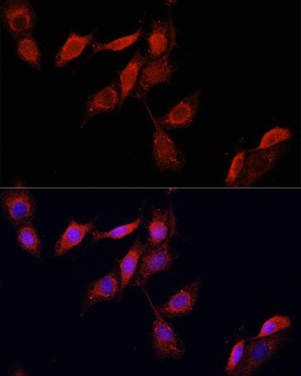GPER1 / GPR30 Antibody