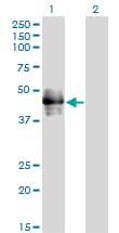 IHC-plus™ CD177 Antibody (clone 4C4)