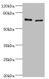 TGM2 / Transglutaminase 2 Antibody (aa438-687)
