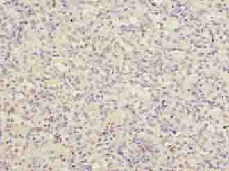 Polyclonal Rabbit anti-Human LRRC3B Antibody (IHC)