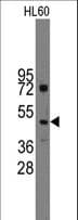 IHH Antibody (aa169-200)