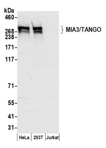 Polyclonal Rabbit anti-Human TANGO / MIA3 Antibody (aa1-50, WB)