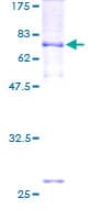 Human TMC6 Protein (Recombinant GST)