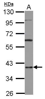 HNRNPD / AUF1 Antibody