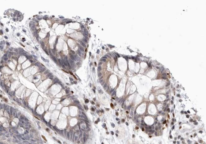 GRM8 / MGLUR8 Antibody