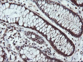 UBE2E3 Antibody (clone OTI7E8)