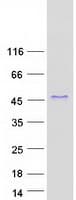 Human CRELD2 Protein (Recombinant Myc-DDK (Flag))