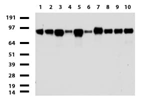 Monoclonal Mouse anti-Human MCAM / CD146 Antibody (clone UMAB154, Carrier-free, IHC, WB)