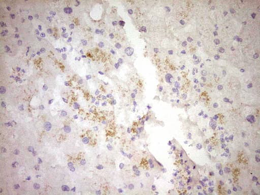 Monoclonal Mouse anti-Human CTGF Antibody (clone OTI4B12, aa27-349, IHC, WB)