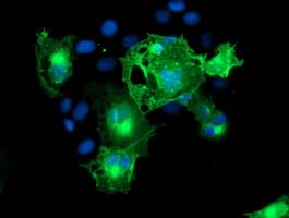 ERBB2 / HER2 Antibody (aa676-1255, clone OTI11A7, Carrier-free)