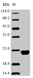 Mouse SLC7A10 / Asc-1 Protein (Recombinant 6His-SUMO, N-terminus)