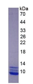 Human CCL3 / MIP-1-Alpha Protein (Recombinant His, N-Terminal)