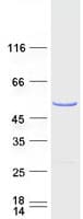 Human HNRNPH1 / hnRNP H Protein (Recombinant Myc-DDK (Flag))