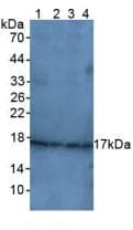 CDKN1A / WAF1 / p21 Antibody (aa1-164)
