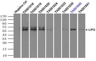 LIPG / Endothelial Lipase Antibody (clone OTI7C2)