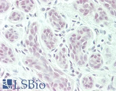 IHC-plus™ POLR2C Antibody (aa225-275)