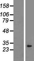 Human IL1A / IL-1 Alpha Protein (Over-Expression Lysate Myc-DDK (Flag))