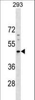Polyclonal Rabbit anti-Human PNMA5 Antibody (aa387-416, WB)