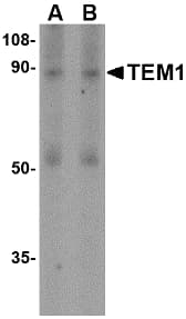 TEM1 / CD248 Antibody