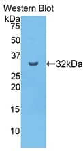 CPB2 / TAFI Antibody (aa164-417)