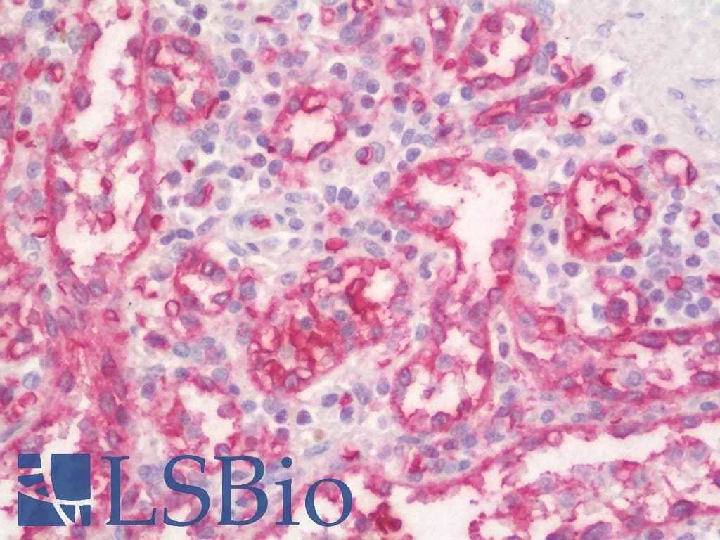 IHC-plus™ PPP1R11 Antibody