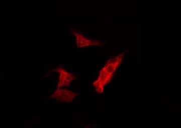 MARK2 Antibody