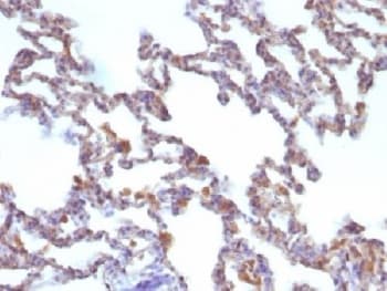 MSN / Moesin Antibody (clone MSN/491)
