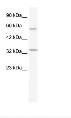 ZBTB7A / Pokemon Antibody (aa224-273, FITC)